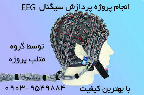 انجام پروژه پردازش سیگنال EEG